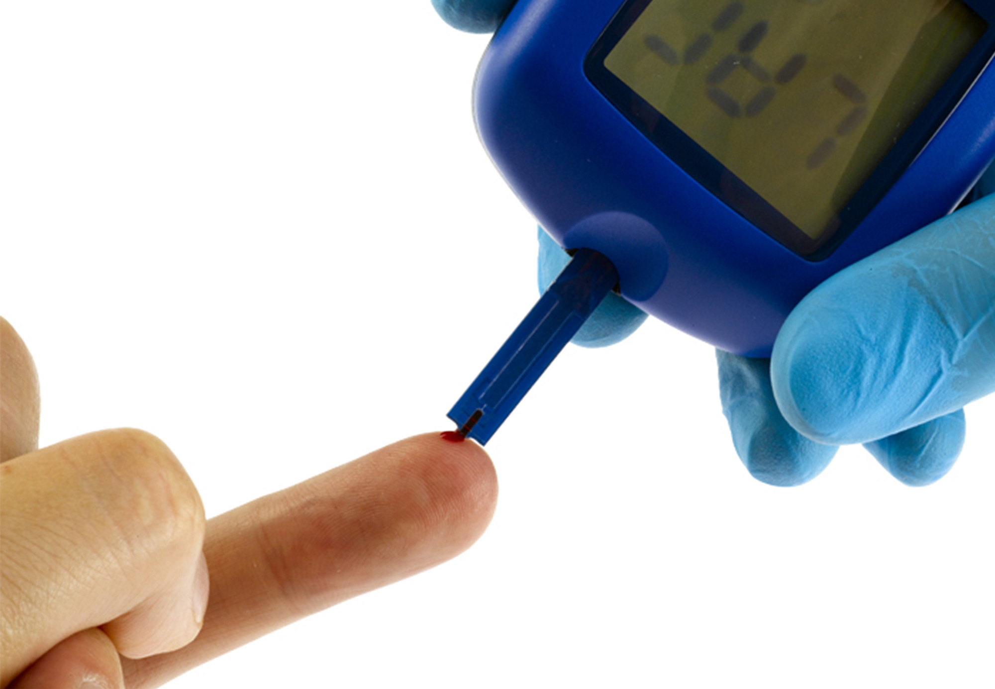 Valutazione Metabolica